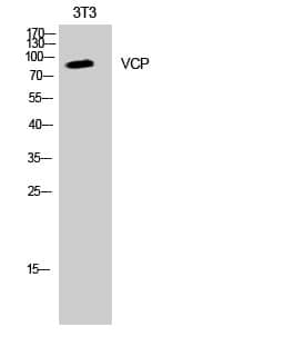 Anti-VCP Antibody
