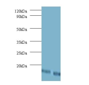 Anti-Dolichyl-diphosphooligosaccharide--protein glycosyltransferase subunit DAD1 Antibody