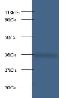 Anti-Cytochrome c1, heme protein, mitochondrial Antibody