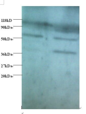 Anti-Heterogeneous nuclear ribonucleoprotein Q Antibody