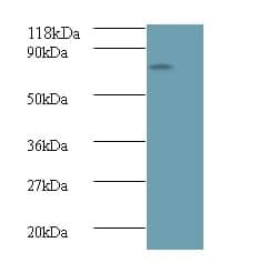 Anti-Islet cell autoantigen 1 Antibody