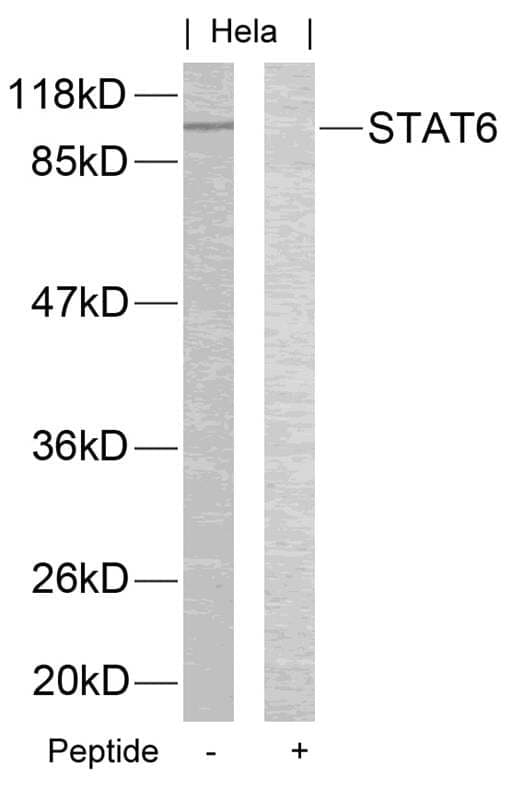Anti-STAT6 (Ab-645) Antibody