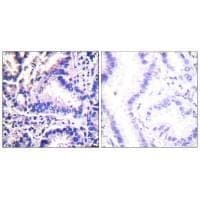 Anti-Synuclein γ Antibody