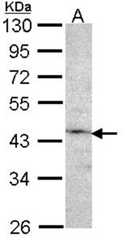 Anti-Factor IX Antibody