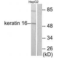 Anti-Keratin 16 Antibody