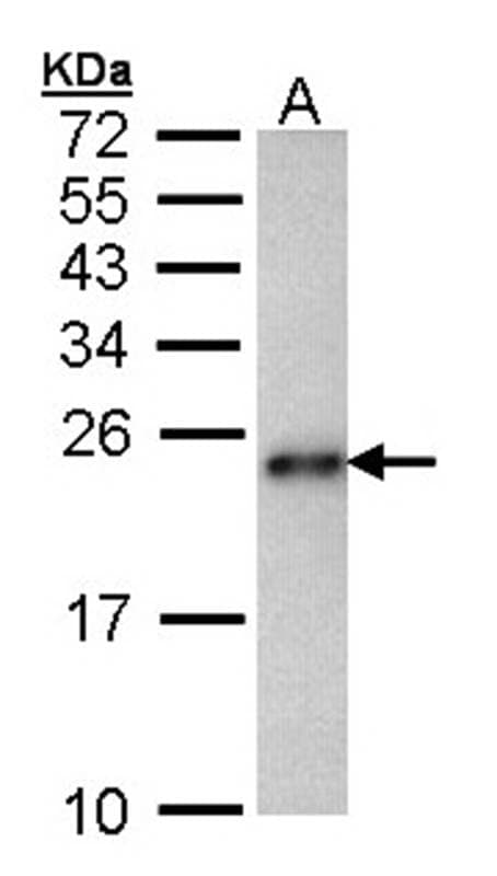 Anti-CRHSP-24 Antibody