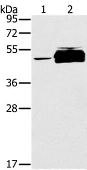 Anti-PTPN20B Antibody