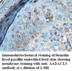 Anti-AADACL3 Antibody