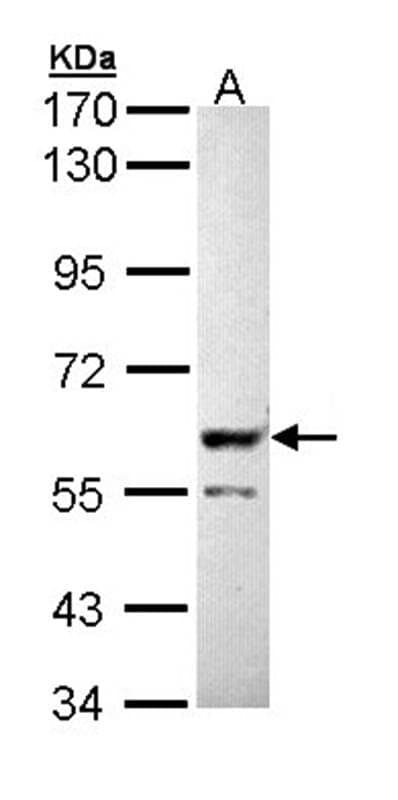 Anti-PPP3CB Antibody