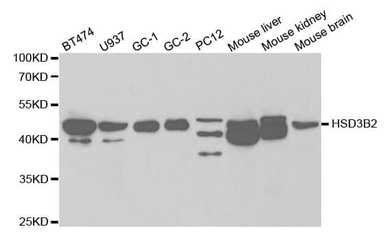 Anti-HSD3B2 Antibody