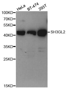 Anti-SH3GL2 Antibody