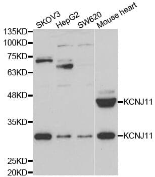 Anti-KCNJ11 Antibody