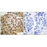 Anti-ERK1 / 2 Antibody