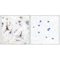 Anti-PGP9.5 Antibody