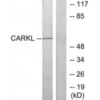 Anti-CARKL Antibody