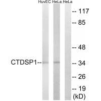 Anti-CTDSP1 Antibody
