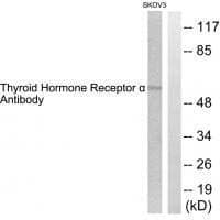 Anti-Thyroid Hormone Receptor α Antibody