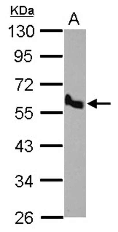 Anti-BMP10 Antibody