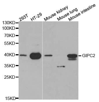 Anti-GIPC2 Antibody