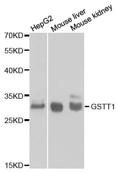 Anti-GSTT1 Antibody